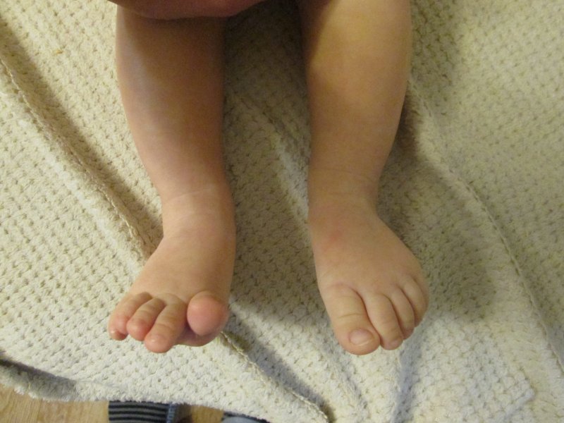 Ножки в 6 месяцев